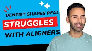 The TRUTH Behind Doing Invisalign from a General Dentist - Everything I know about Invisalign