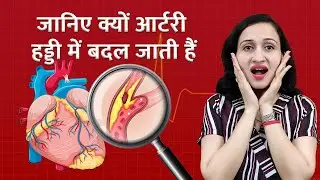Why You MUST Take Vitamin K2 To Prevent A Heart Attack | Vitamin k2 benefits | Vitamin K2 rich foods