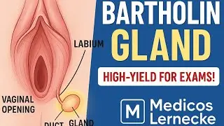 #Bartholin gland#bartholin cyst# bartholin abscess#medicos lernecke