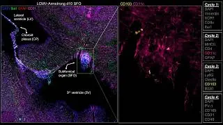[JR_IBEX_003] LCMV-Armstrong d10 SFO (subfornical organ)