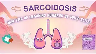 Sarcoidosis for MRCP Part 1 & 2: High-Yield Clinical Review