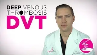 Deep Venous Thrombosis DVT  MagicSurgeon The Video Series