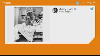 Chrissy Teigen loses baby after pregnancy complications