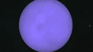 Esame Fondo Oculare