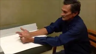 Dupuytren's contracture minimally invasive needle aponeurotomy- James M. Lin, MD, Monterey, CA