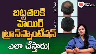 The ABSOLUTE BEST Hair Transplant Surgery Method in 2026! | TeluguOne Health