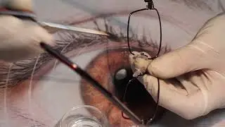 REPARATII OCHELARI. EPISODUL 1: PUFER NAZAL RUPT/EYEWEAR REPAIR: BROKEN NOSE PAD