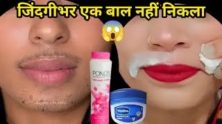 दाढ़ी मूछ से 4 साल से परेशान थी और इसे सिर्फ एक बार लगाया | anchahe Baal#skincare #wax #facialhair