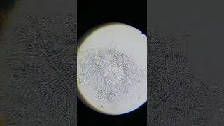 My dog's saliva under a microscope part 2, magnified 35x #microscope #magnifiedworld #microscopic