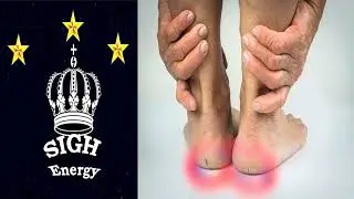 Cracked heels and feet Healing EXTREMELY POWERFUL!!! (Energetically Programmed)