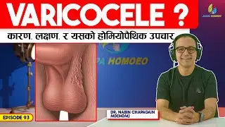 भेरिकोसिल (Varicocele) को समस्या: कारण, लक्षण र होमियोपैथिक समाधान | Ep - 93 | Dr. Nabin Chapagain
