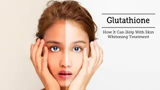 Glutathione Skin Whitening - Answers to your top questions. (fougees beauty)
