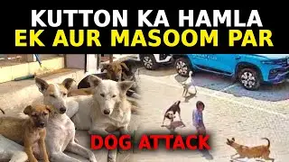 Kutton Ka Hamla Ek aur Masoom Par | Another Dogs Attack in Hyderabad | TVN99 Urdu