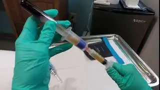 PRP Extraction