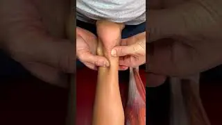 Achilles Tendonitis Massage