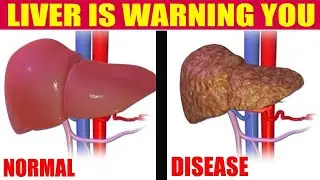 HOW CAN LIVER DISEASES AND CAUSES, SYMPTOMS, TREATMENT | Nature Cure Fit