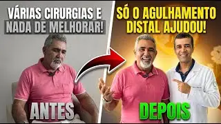 V&Aacute;RIAS CIRURGIAS E NADA DE MELHORAR! S&oacute; o agulhamento distal conseguiu ajudar.