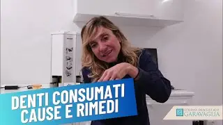 Denti Consumati: Cause e Rimedi Spiegati dalla Dott.ssa Garavaglia di Busto Arsizio (VA)