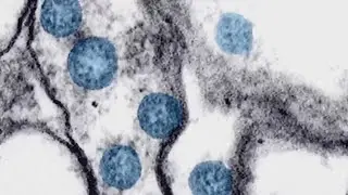 &lsquo;Stealth omicron&rsquo; sub-variant found in Washington state