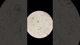 identify? urine , sample, microbiology, microscopic, examination, medical, laboratory, science, new
