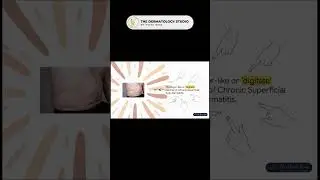 Types of Eczema Explained: Nummular, Asteatotic, Pityriasis Alba & CSSD