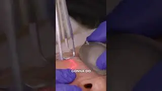 Ultra Clear Laser Treatment in Savannah | Customized Skin Rejuvenation with Dr. Finger