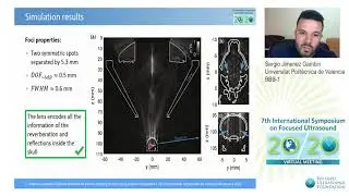 Sergio Jim&eacute;nez Gamb&iacute;n - Bilateral BBB Opening in Mice Using Acoustic Holograms (2020)