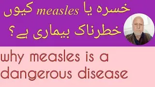 measles treatment for babies |measles symptoms | javedan pharmacy.
