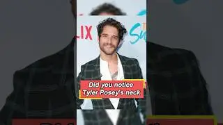 Did you notice Tyler Posey's neck He made three sacrifices to make Teen Wolf.#tylerposey #teenwolf