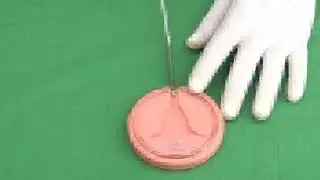 Technique of Intra Uterine Contraceptive Device Insertion