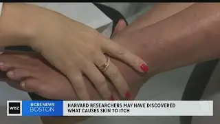 Researchers may have found what causes eczema itch