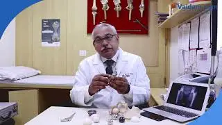 Total Hip Replacement - Best Explained by Dr. Vivek Mittal of BLK Hospital, New Delhi
