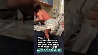 Just born baby can walk already. This is the proof 2025 babies build differently😯😲🤔 #medicalyukti