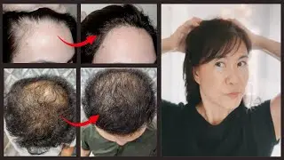 Simple and Yet Powerful Techniques to Massage your Scalp for the Optimum Hair Growth and Lifts Face!