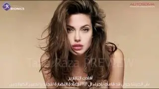 Autosoma DERMA ArabicSUBS