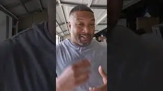 African American Hair Transplant (All about what you can live with)