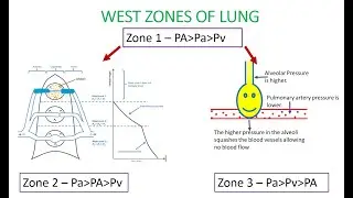 LEARN WEST LUNG ZONES EASILY /Zone 1 Zone 2 Zone 3 in lung/ lung zones anatomy /Highest ventilation.