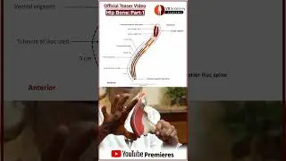 Overview : HIP BONE &ndash; PART 1 of 4 | Anatomical Position, Ilium