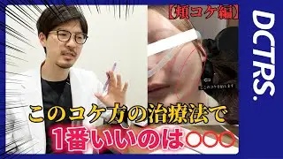 【頬コケ編治療比較】あなたのコケ具合はどっちが適応？ヒアル？脂肪注入？【徹底解説】
