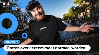Rapper Donnie wil meer aandacht voor eczeem