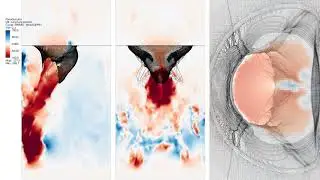 Mitral valve simulation, commissural leaflet version, slow motion