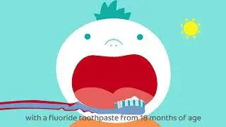 Ask Colgate: How to prevent tooth decay in your toddler?