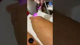 Peli superflui? No grazie! Epilazione con Laser DIODO 808 - E-Sun Estetica - Rivolta d&rsquo;Adda