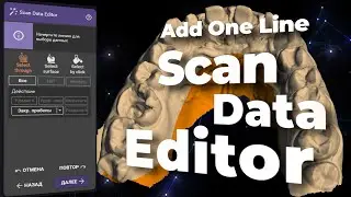 Update Exocad Scan Data Editor