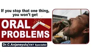 Mouth Opening Problem Due To Tobacco | Oral Problem | Dr Chava Anjaneyalu || Socialpost Healthcare