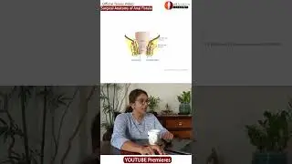Teaser Anal Fistula Demystified: A Step-by-Step Surgical Anatomy Guide