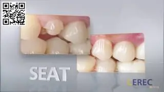 Dentist in Elk Grove Best Dentist in Elk Grove CA Providing CEREC