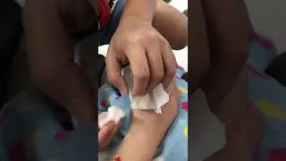 Removal of my last IV heplock for Antibiotics (Dec 31, 2022)