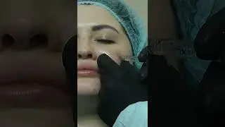 Делаем красивые скулы.