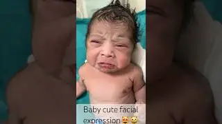 Baby cute facial expression😻#Shorts#newborn 😸